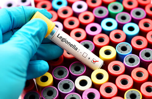 Rischio legionella, siglata la convenzione fra Confesercenti e il Laboratorio chimico della Camera di Commercio